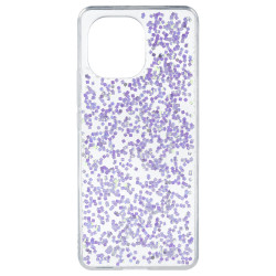 Funda Glitter Premium para Xiaomi Mi 11 - La Casa de las Carcasas, Accesorios y Fundas para móviles